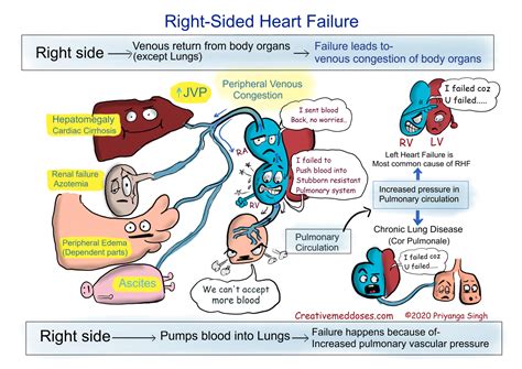 right vs left heart failure